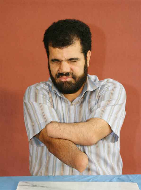 گزیده احکام رساله مصور جانبازان؛ احکام تیمم(1) تیمّم کسی که دستانش قطع شده گزیده احکام رساله مصور جانبازان؛ احکام تیمم(1) تیمّم کسی که دستانش قطع شده